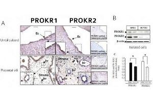 PROKR1 and PROKR2 protein expression in placental-tissue umbilical cord and in isolated HPECs and HUVECs (A) Immunohistochemistry of chorionic villi and ombilical cord sections using antibodies to PROKR1 and PROKR2. (Prokineticin Receptor 1 antibody  (N-Term))
