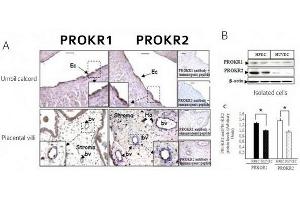 PROKR1 and PROKR2 protein expression in placental-tissue umbilical cord and in isolated HPECs and HUVECs (A) Immunohistochemistry of chorionic villi and ombilical cord sections using antibodies to PROKR1 and PROKR2.
