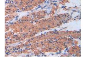IHC-P analysis of Human Stomach Tissue, with DAB staining. (CRP antibody  (AA 17-224))