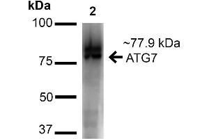 Western blot analysis of Human Cervical Cancer cell lysates (HeLa) showing detection of ~77. (ATG7 antibody  (N-Term) (HRP))