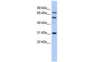 Image no. 1 for anti-Structure Specific Recognition Protein 1 (SSRP1) (AA 503-552) antibody (ABIN6742197) (SSRP1 antibody  (AA 503-552))
