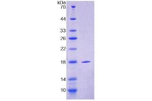 SDS-PAGE (SDS) image for CD209 (CD209) (AA 115-238) protein (T7 tag,His tag) (ABIN6238751)