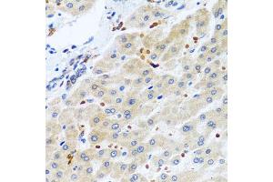 Immunohistochemistry of paraffin-embedded human liver using RGS5 antibody. (RGS5 antibody)
