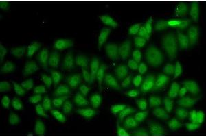 Immunofluorescence analysis of HeLa cells using ATXN1 Polyclonal Antibody (Ataxin 1 antibody)