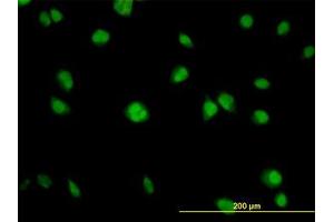Image no. 4 for anti-V-Akt Murine Thymoma Viral Oncogene Homolog 1 (AKT1) (AA 1-481) antibody (ABIN598531) (AKT1 antibody  (AA 1-481))