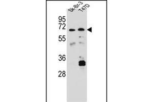 CES8 Antibody (C-term) (ABIN656888 and ABIN2846087) western blot analysis in Sk-Br-3,T47D cell line lysates (35 μg/lane).