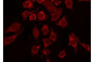 ABIN6267418 staining COS7 by IF/ICC. (GABA-RB (pSer434) antibody)