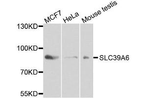 Western blot analysis of extracts of various cell lines, using SLC39A6 antibody. (SLC39A6 antibody  (AA 170-320))