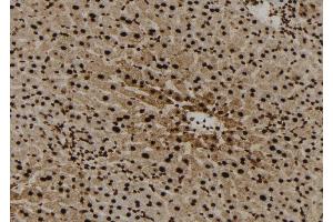 ABIN6272959 at 1/100 staining Mouse liver tissue by IHC-P.