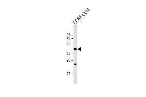 Western Blot at 1:1000 dilution + CCRF-CEM whole cell lysate Lysates/proteins at 20 ug per lane. (PTAR1 antibody  (AA 60-89))