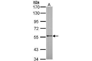 WB Image Sample (30 ug of whole cell lysate) A: Molt-4 , 7. (RAG2 antibody  (Center))