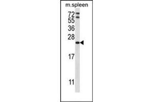 Western blot analysis of RAP1A Antibody (C-term) in mouse spleen tissue lysates (35ug/lane). (RAP1A antibody  (C-Term))