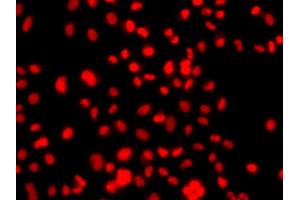 Immunofluorescence analysis of A549 cells using PRICKLE2 antibody (ABIN5974952).