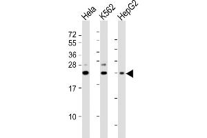All lanes : Anti-SRY Antibody (N-Term) at 1:2000 dilution Lane 1: Hela whole cell lysates Lane 2: K562 whole cell lysates Lane 3: HepG2 whole cell lysates Lysates/proteins at 20 μg per lane. (SRY antibody  (AA 52-82))
