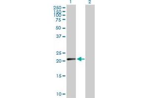 Western Blot analysis of N6AMT1 expression in transfected 293T cell line by N6AMT1 MaxPab polyclonal antibody.