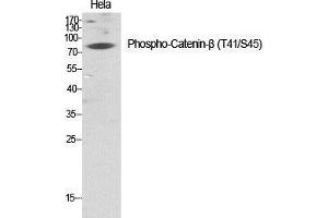 Western Blot (WB) analysis of specific cells using Phospho-Catenin-beta (T41/S45) Polyclonal Antibody. (beta Catenin antibody  (pSer45, pThr41))
