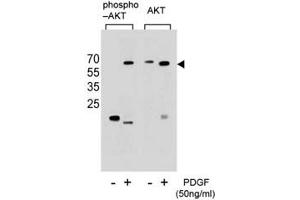Western blot analysis of extracts from NIH3T3 cells, untreated or treated with PDGF, using phospho-AKT antibody (left) or nonphos-AKT antibody (right).