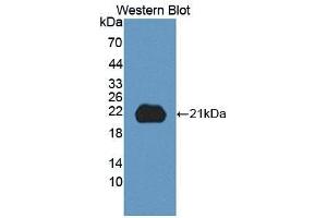 Detection of Recombinant ITGb8, Human using Polyclonal Antibody to Integrin Beta 8 (ITGb8) (ITGB8 antibody  (AA 471-629))