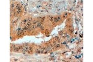 AP23772PU-N SEMA3E antibody staining of Paraffin Embedded Human Prostate at 4 µg/ml. (SEMA3E antibody  (Internal Region))