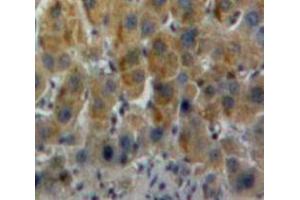 Used in DAB staining on fromalin fixed paraffin-embedded Liver tissue (CSTB antibody  (AA 2-98))