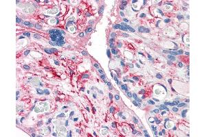 Anti-CD26 antibody IHC of human placenta.