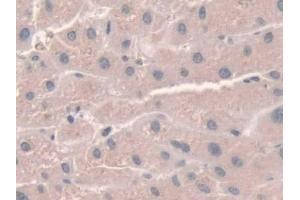 Detection of NOX1 in Human Liver Tissue using Polyclonal Antibody to Nicotinamide Adenine Dinucleotide Phosphate Oxidase 1 (NOX1) (NOX1 antibody  (AA 235-488))