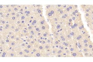 Detection of CARNS1 in Mouse Liver Tissue using Polyclonal Antibody to Carnosine Synthase 1 (CARNS1) (CARNS1 antibody  (AA 623-826))