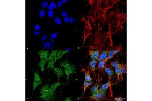 Immunocytochemistry/Immunofluorescence analysis using Rabbit Anti-UVRAG Polyclonal Antibody . (UVRAG antibody  (C-Term) (FITC))