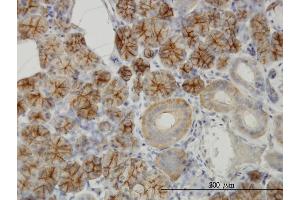 Immunoperoxidase of monoclonal antibody to RHCG on formalin-fixed paraffin-embedded human salivary gland. (RHCG antibody  (AA 418-479))