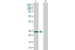 Western Blot analysis of SPA17 expression in transfected 293T cell line by SPA17 MaxPab polyclonal antibody. (SPA17 antibody  (AA 1-151))