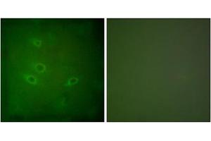 Immunofluorescence analysis of HeLa cells, using CARD6 antibody. (CARD6 antibody  (N-Term))