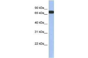 WB Suggested Anti-GNL3L Antibody Titration: 0. (GNL3L antibody  (N-Term))