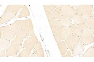 Detection of ITIH3 in Human Skeletal muscle Tissue using Polyclonal Antibody to Inter Alpha-Globulin Inhibitor H3 (ITIH3) (ITIH3 antibody  (AA 279-467))