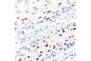 Immunohistochemistry (IHC) image for anti-Cyclin-Dependent Kinase Inhibitor 1A (p21, Cip1) (CDKN1A) antibody (ABIN7266599)