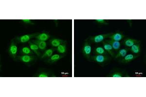 ICC/IF Image RAP1 antibody [N2C3] detects RAP1 protein at nucleus and cytoplasm by immunofluorescent analysis. (RAP1 antibody  (Center))