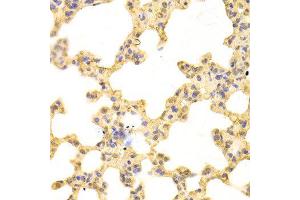 Immunohistochemistry (IHC) image for anti-Proteasome Subunit alpha Type 1 (PSMA1) (AA 1-263) antibody (ABIN3016184) (PSMA1 antibody  (AA 1-263))