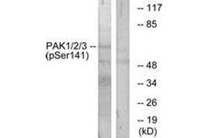 Western blot analysis of extracts from mouse brain, using PAK1/2/3 (Phospho-Ser144/141/139) Antibody. (PAK1/2/3 antibody  (pSer144))