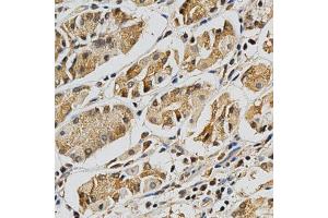 Immunohistochemistry of paraffin-embedded human stomach using LGALS3 antibody at dilution of 1:200 (x400 lens) (Galectin 3 antibody  (AA 1-250))