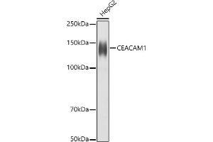 Western blot analysis of extracts of HepG2 cells, using CE antibody (ABIN3015546, ABIN3015547, ABIN3015548 and ABIN6218802) at 1:1000 dilution.