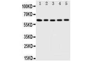 Anti-Iduronate 2 sulfatase antibody, Western blotting Lane 1: HELA Cell Lysate Lane 2: SMMC Cell Lysate Lane 3: A549 Cell Lysate Lane 4: MCF-7 Cell Lysate Lane 5: COLO Cell Lysate (IDS antibody  (C-Term))