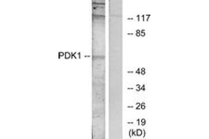 Western blot analysis of extracts from MDA-MB-435 cells, treated with EGF, using PDK1 (Ab-241) Antibody. (PDPK1 antibody  (AA 210-259))