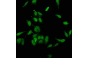 Immunofluorescence staining of Hela cells with ABIN7145812 at 1:200, counter-stained with DAPI. (BRD4 antibody  (AA 150-200))