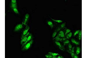 Immunofluorescent analysis of Hela cells using ABIN7164586 at dilution of 1:100 and Alexa Fluor 488-congugated AffiniPure Goat Anti-Rabbit IgG(H+L) (ATP9A antibody  (AA 2-69))