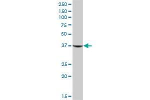 AKR1C1 MaxPab polyclonal antibody. (AKR1C1 antibody  (AA 1-323))