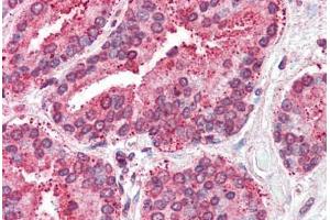 Anti-TSPAN6 antibody  ABIN960831 IHC staining of human prostate. (Tetraspanin 6 antibody  (Internal Region))