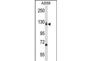 Western blot analysis of EFTUD2 Antibody (Center) (ABIN653236 and ABIN2842767) in  cell line lysates (35 μg/lane). (EFTUD2 antibody  (AA 257-284))
