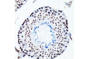 Immunohistochemistry of paraffin-embedded mouse testis using Phospho-Histone H2AX-S139 antibody (ABIN6135258, ABIN6136140, ABIN6136141 and ABIN7101881) at dilution of 1:100 (40x lens). (Histone H2A antibody  (pSer139))