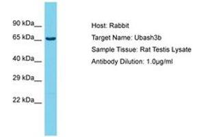 Image no. 1 for anti-Cbl-Interacting Protein Sts-1 (STS1) (AA 564-613) antibody (ABIN6750419) (UBASH3B antibody  (AA 564-613))