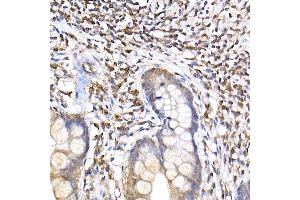 Immunohistochemistry of paraffin-embedded human small intestine using TR Rabbit mAb (ABIN7270870) at dilution of 1:200 (40x lens). (TRAPPC2 antibody)