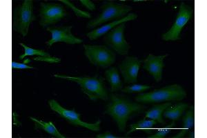 Immunofluorescence of monoclonal antibody to PAFAH1B1 on HeLa cell. (PAFAH1B1 antibody  (AA 1-110))